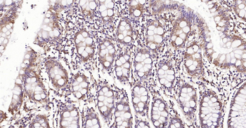 HSP47 Ready-To-Use IHC Kit