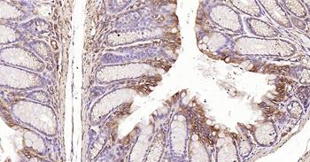 HSP47 Ready-To-Use IHC Kit
