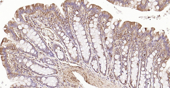 HSP47 Ready-To-Use IHC Kit
