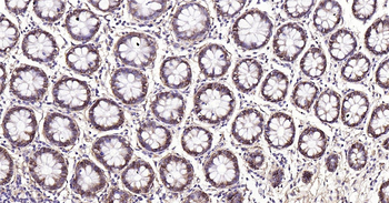 Human Integrin beta 1 Ready-To-Use IHC Kit
