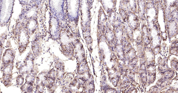 Human Integrin beta 1 Ready-To-Use IHC Kit
