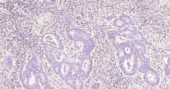 Human S100A4 Ready-To-Use IHC Kit