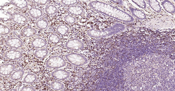 Human S100A4 Ready-To-Use IHC Kit