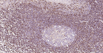 Human S100A4 Ready-To-Use IHC Kit