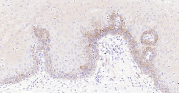 Human CD1A Ready-To-Use IHC Kit