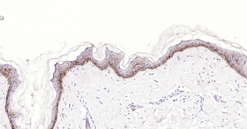 Human CD1A Ready-To-Use IHC Kit
