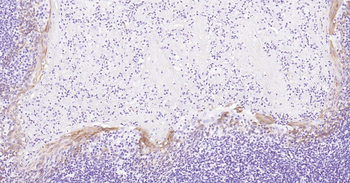 Human CD1A Ready-To-Use IHC Kit