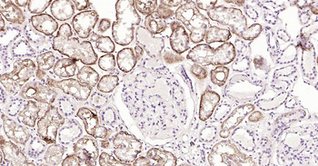 CD138 Ready-To-Use IHC Kit