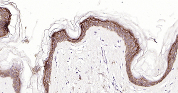 CD138 Ready-To-Use IHC Kit