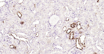 CD138 Ready-To-Use IHC Kit
