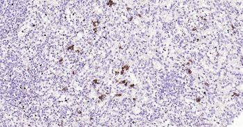 Human CD38 Ready-To-Use IHC Kit