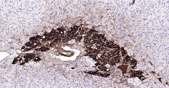 Tyrosine Hydroxylase Ready-To-Use IHC Kit