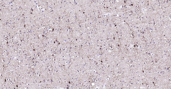 Human NMDAR1 Ready-To-Use IHC Kit
