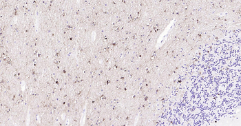 NMDAR1 Ready-To-Use IHC Kit