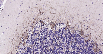 Human NF-M Ready-To-Use IHC Kit