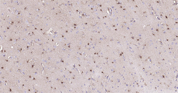 Human S100A1 Ready-To-Use IHC Kit