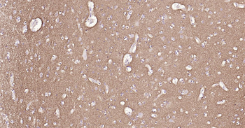 GAP43 Ready-To-Use IHC Kit