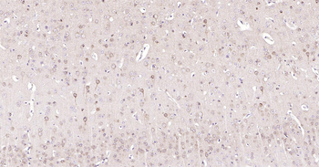 Mouse STMN1 Ready-To-Use IHC Kit