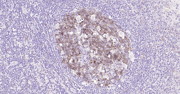 Human STMN1 Ready-To-Use IHC Kit