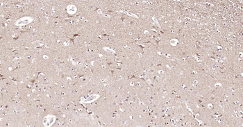 STMN1 Ready-To-Use IHC Kit