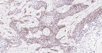 STMN1 Ready-To-Use IHC Kit