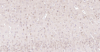 STMN1 Ready-To-Use IHC Kit