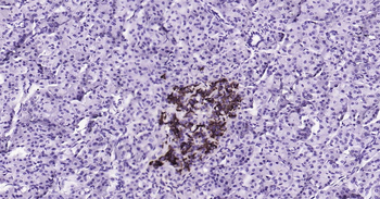 Human Notch1 Ready-To-Use IHC Kit