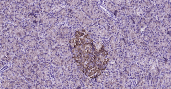 Notch1 Ready-To-Use IHC Kit