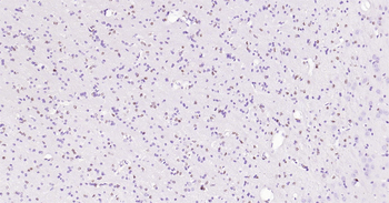 Rat SOX2 Ready-To-Use IHC Kit