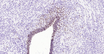 Rat SOX2 Ready-To-Use IHC Kit