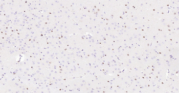 SOX2 Ready-To-Use IHC Kit