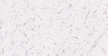 Human Nestin Ready-To-Use IHC Kit