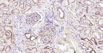 Human Nestin Ready-To-Use IHC Kit
