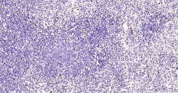 Human Nestin Ready-To-Use IHC Kit