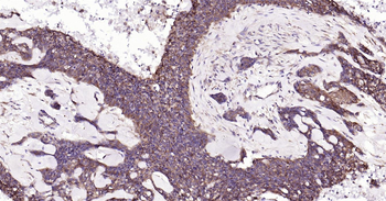 Human NFKB p65 Ready-To-Use IHC Kit