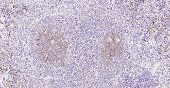 NFKB p65 Ready-To-Use IHC Kit
