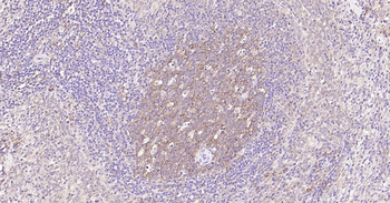 NFKB p65 Ready-To-Use IHC Kit