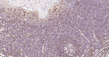 Human HLA E Ready-To-Use IHC Kit
