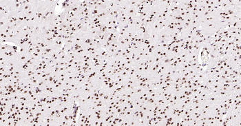 Mouse Phospho-SRF (Ser77) Ready-To-Use IHC Kit