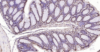 Mouse Phospho-SRF (Ser77) Ready-To-Use IHC Kit