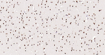 Human Phospho-SRF (Ser77) Ready-To-Use IHC Kit