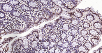 Human Phospho-SRF (Ser77) Ready-To-Use IHC Kit
