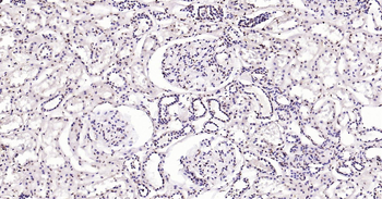 Phospho-SRF (Ser77) Ready-To-Use IHC Kit