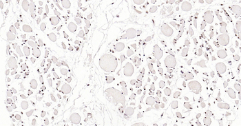 Phospho-SRF (Ser77) Ready-To-Use IHC Kit