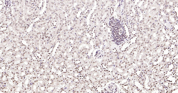 Phospho-SRF (Ser77) Ready-To-Use IHC Kit