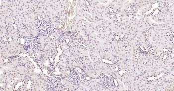 Phospho-SRF (Ser77) Ready-To-Use IHC Kit