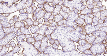 Human TFRC Ready-To-Use IHC Kit