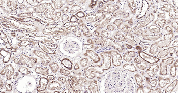 Human CRIM1 Ready-To-Use IHC Kit