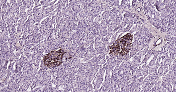 Human CHGA Ready-To-Use IHC Kit