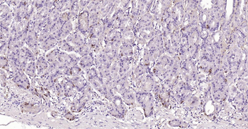 CHGA Ready-To-Use IHC Kit